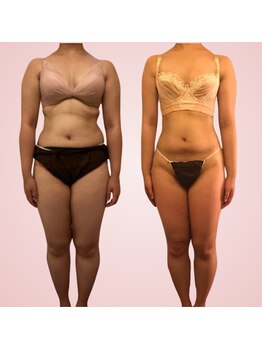 シエスタ(SIESTA)/Before→After 　1年間の変化