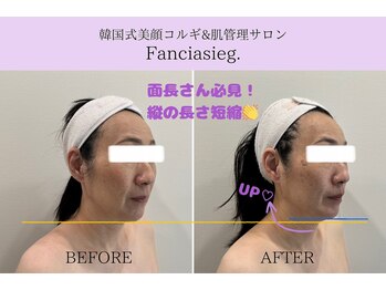 ファンシアジーク(Fanciasieg.)/韓国式美顔コルギ