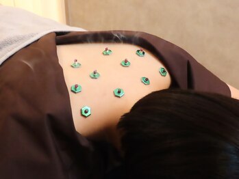 とまり木鍼灸整骨院/