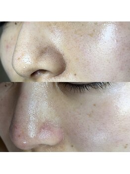 シャイニー(SHINY)/30代女性