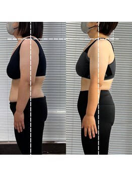 ラフィット(laugh fit)/ビフォーアフター