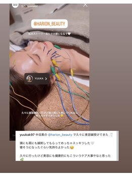 ハリオン 中目黒(HARI-ON)/#インディバ#美容鍼