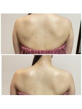 ブリランテ(Brillante)/