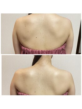 ブリランテ(Brillante)/