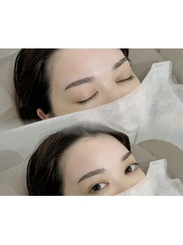 お肌をきれいにしたい