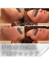 スイ スーパースカルプ松阪店(SUI)/フェイシャル　