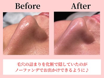 ココロ(COCORO)/美脳小顔矯正&毛穴洗浄