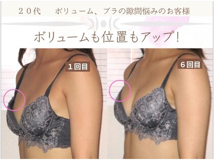 バストサロン メルベイユ(Merveile)の写真