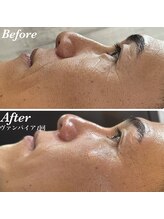 ミランオオサカ(MIRAN OSAKA)/