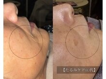 ル シーニュ/ハリ・艶・たるみケア