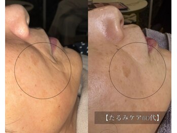 ル シーニュ/ハリ・艶・たるみケア