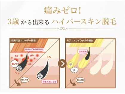 モアトゥインクル 並木通り本店(MORE twinkle)の写真