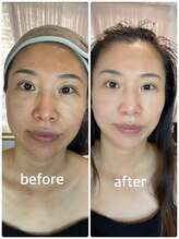 レイ(Lei)/当店のビフォーアフター