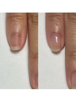 オリ ネイル(Oli_nail)/