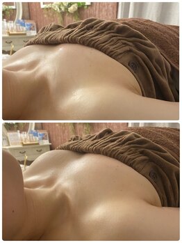 スマイルクルー(SmileClue)/初回ビフォーアフター症例