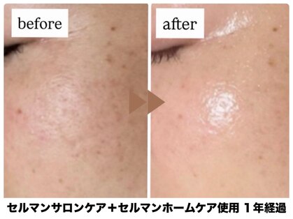 エムイーボーテ(me.Beaute)の写真