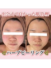 アルムダアクア 天王寺店(Aleumda AQUA)/