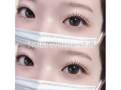 ノエル(NOEL)の写真