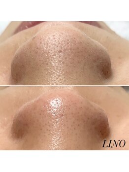 リノ(Lino)/学割コース