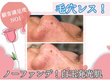 ヤヤ(yaya)の雰囲気（ノーファンデ白玉肌＊徹底的に毛穴汚れを取り除き美容液を補給！）