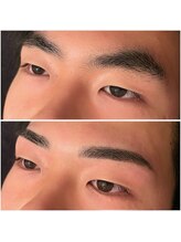 ウイユサロン(oeilsalon)/フェイシャルワックス脱毛