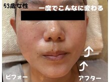 タカキ(TAKAKI)の雰囲気（ほうれい線たるみ改善♪小顔更にスッキリ艶肌な貴方へ）