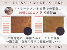 ポアレスラボ 新宿マルイ本館店の雰囲気（独自開発！【50倍CCDカメラ】で撮影し、カウンセリングします♪）