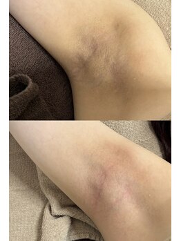 アンドミー(and me)/ローマピンク