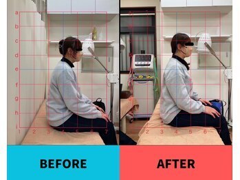 瑞江駅前はりきゅう整骨院/お客様のビフォー・アフター