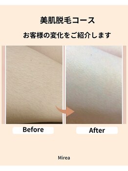 ミレア(Mirea)/全身から部分まで色々選べる