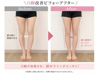 肌質改善ラボの写真/新宿西口すぐ【ヘッド+小顔矯正+頭蓋骨矯正＋骨盤ヒップup矯正＋美脚矯正＋腸もみ】＋【REVIorララピール】