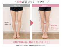 肌質改善ラボ