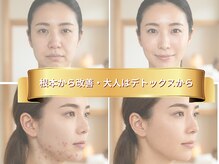 ラディアン/小顔◆オールハンド施術