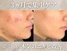 <ハーブピーリング|初回限定>徹底ニキビケア肌管理4回コース|毎月3名まで