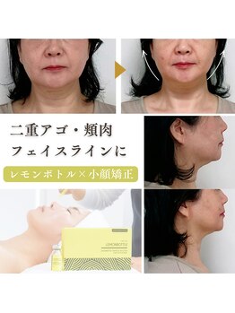 マナレア 湘南(Manalea)の写真/二重あご・顔肉・もたつきに◎小顔矯正×レモンボトルで横顔までスッキリ美しく♪
