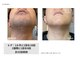 メン脱 三軒茶屋(Men脱)の写真/【脱毛デビュー応援】あなただけに合わせるパーソナル脱毛♪初めてでも安心相談◎