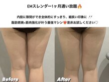 ディメンション 大里店(DIMENSION)/EMスレンダー１ヶ月通い放題