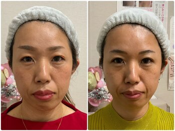 サロンマニア(SALON MANIA)/ビフォアーアフター(8回)