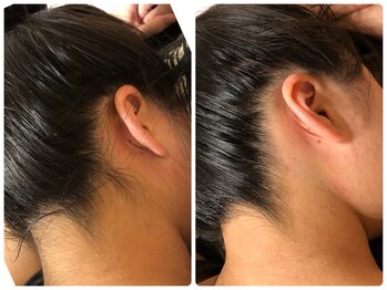 リュミエール(lash&brow lumiere)/うなじ脱毛