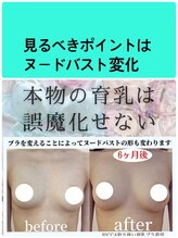 ビサンテ(Vi sante)/バストアップ