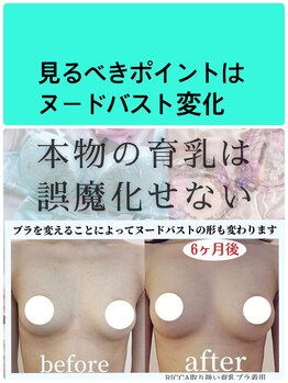 ビサンテ(Vi sante)/バストアップ