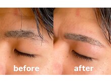 トップルック 横浜店(TOP LOOK)/メンズ眉毛ビフォーアフター