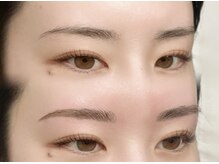 ウル(Ulu.)の雰囲気（様々なお悩みを解決＊before・after写真はフォトギャラリーから）