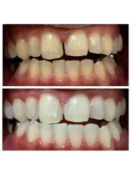 ホワイトプラン/10回でこんなに！？