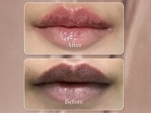 エモーショナル 姫路(Emotional)/ルメラ◎唇のくすみ