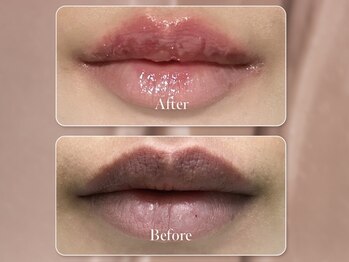 エモーショナル 姫路(Emotional)/ルメラ◎唇のくすみ