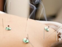 鍼灸や指圧、オイルを使って深層部までほぐします＊