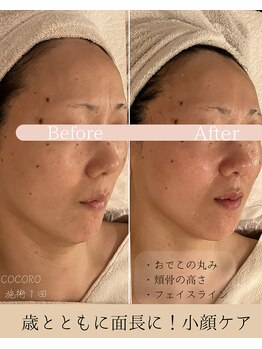 ココロ(COCORO)/憧れのハートしゃいぷな小顔に♪