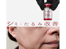 プレイス 太融寺店(PLACE)の雰囲気（韓国発日本上陸【脂肪分解REDSHOT】理想の小顔へ）