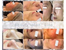 リノ(Lino)の雰囲気（結果重視のサロン！この変化、あなたも体験しませんか？）